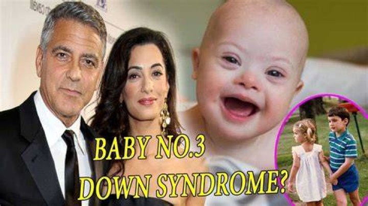 George And Amal Clooney's Journey With Down Syndrome